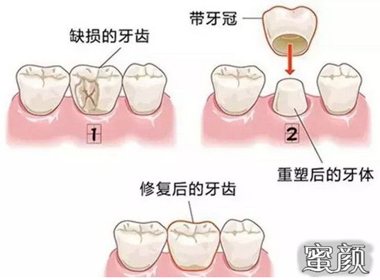 案例图片