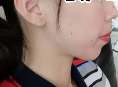 https://img.yiyiaimei.com/mnt/timg/200704/130K5B23-0.jpg 案例图片