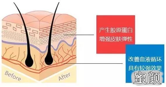 案例图片