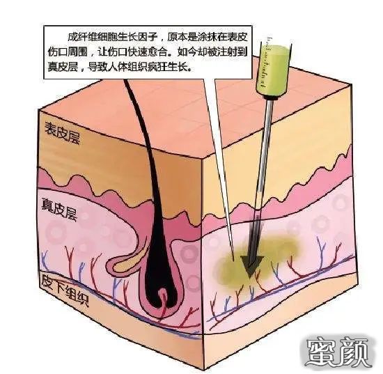 案例图片