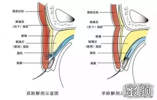 案例图片