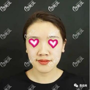 案例图片