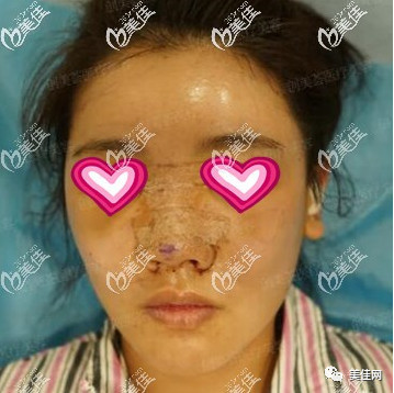 案例图片