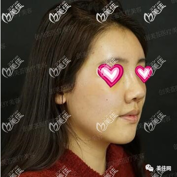 案例图片
