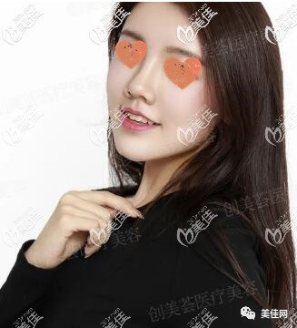 案例图片