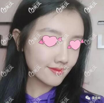 案例图片