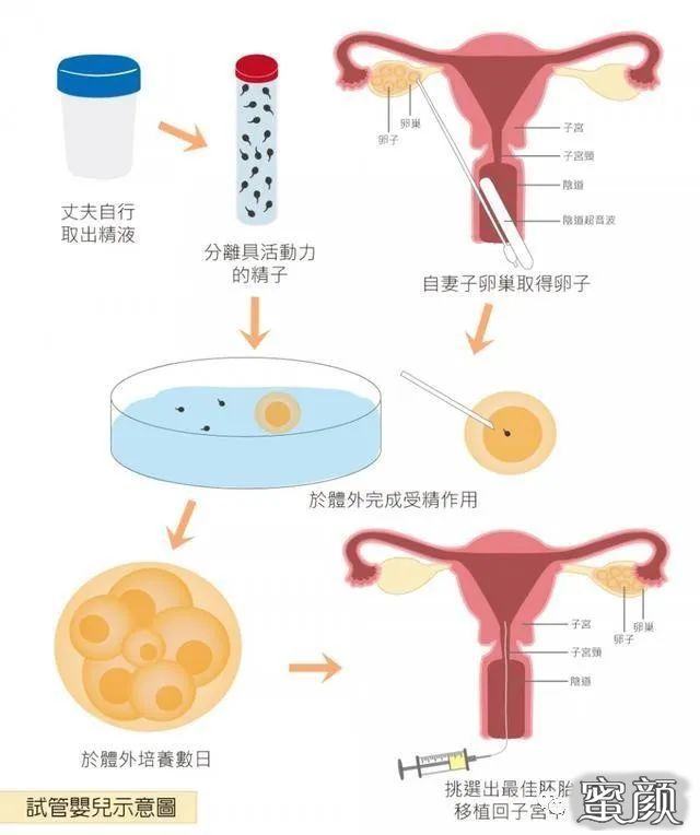 案例图片
