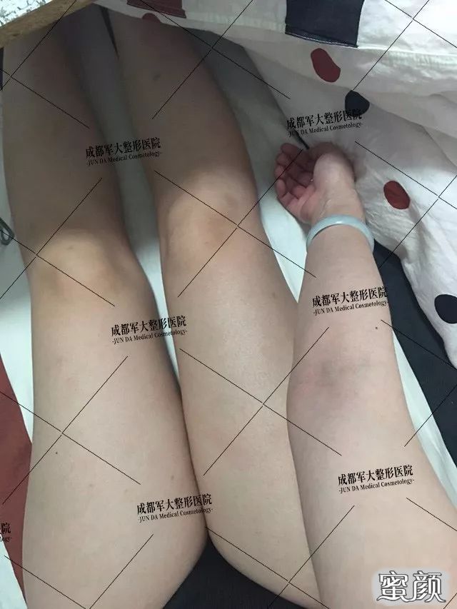 案例图片
