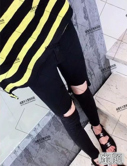 案例图片