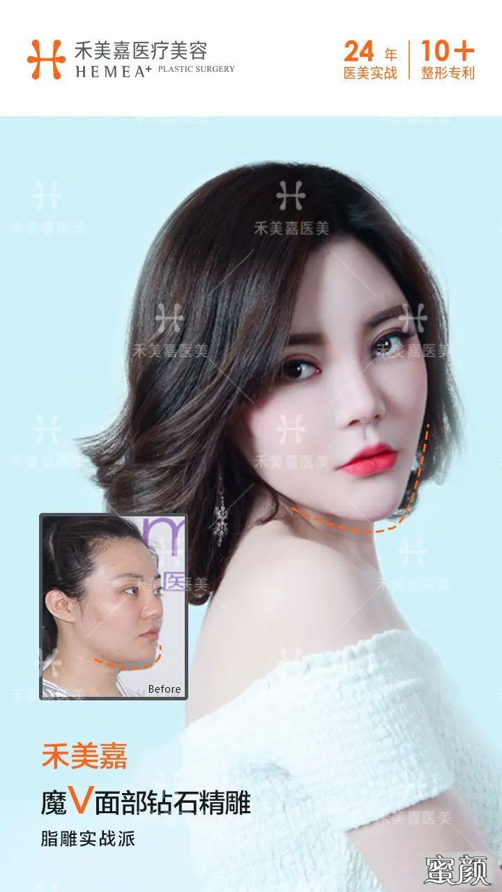 案例图片