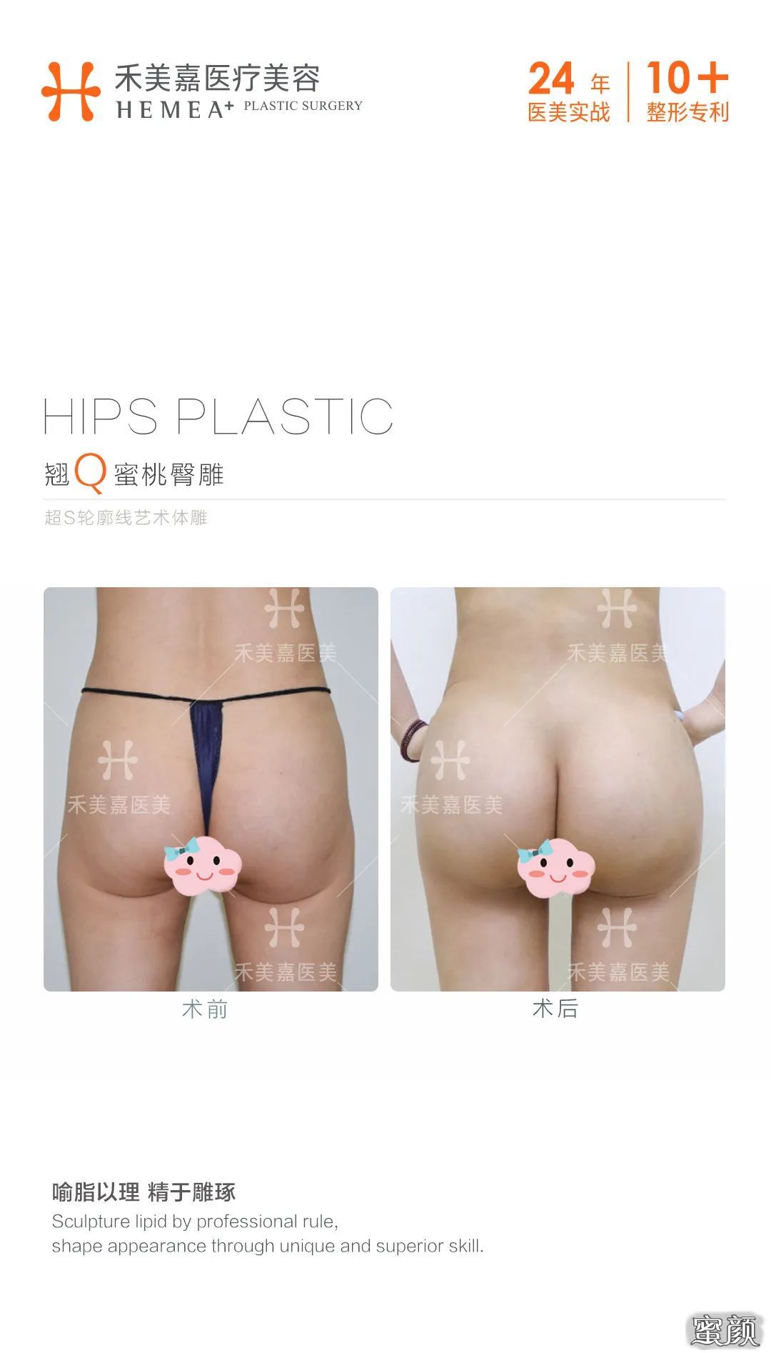 案例图片