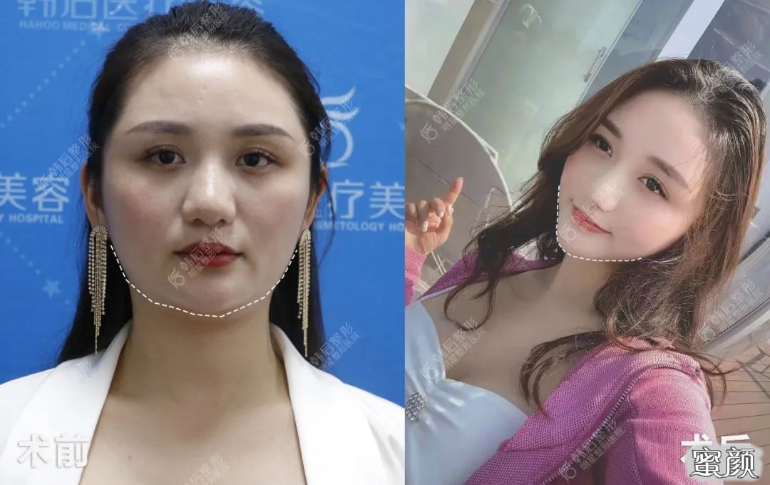 案例图片