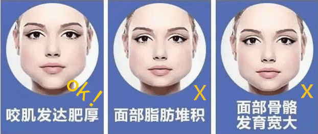 案例图片