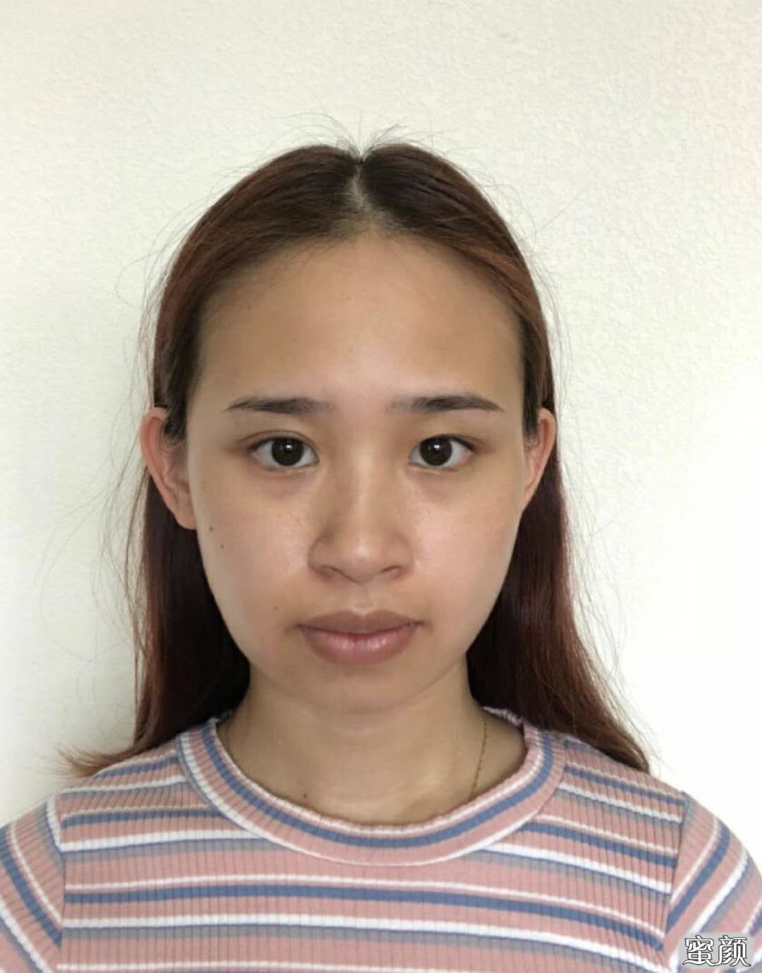 案例图片