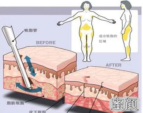 案例图片