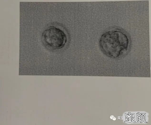 https://img.yiyiaimei.com/mnt/timg/200708/12341555W-3.jpg 案例图片