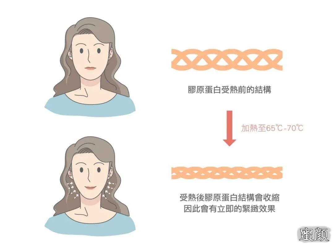 https://img.yiyiaimei.com/mnt/timg/200709/13321C0N-1.jpg 案例图片