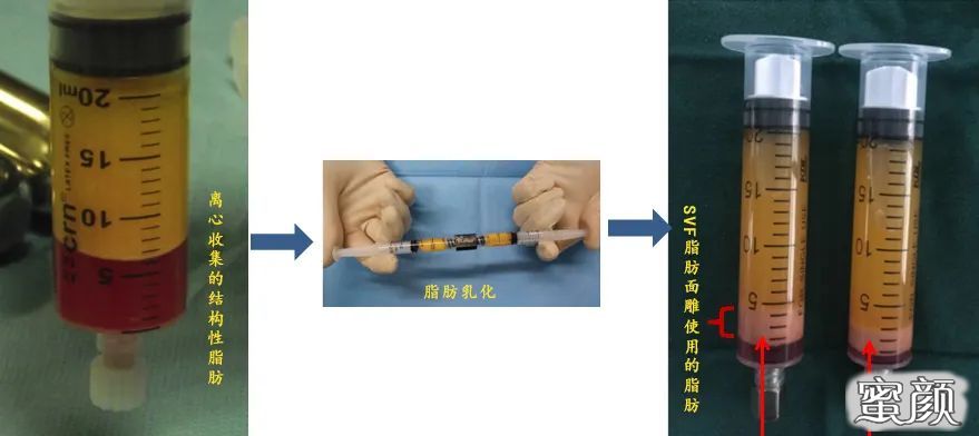 https://img.yiyiaimei.com/mnt/timg/200710/111120A18-0.jpg 案例图片