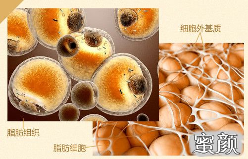 https://img.yiyiaimei.com/mnt/timg/200710/1111221304-1.jpg 案例图片