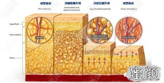 案例图片