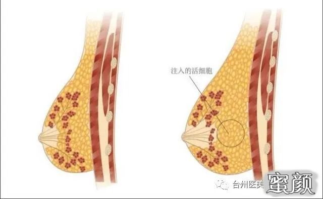 案例图片