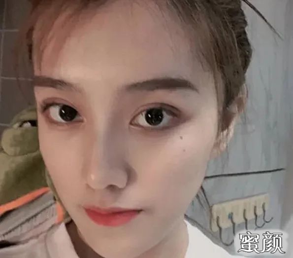 案例图片