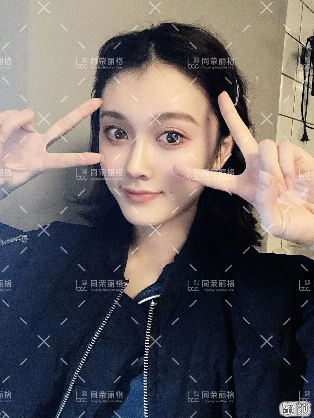 案例图片