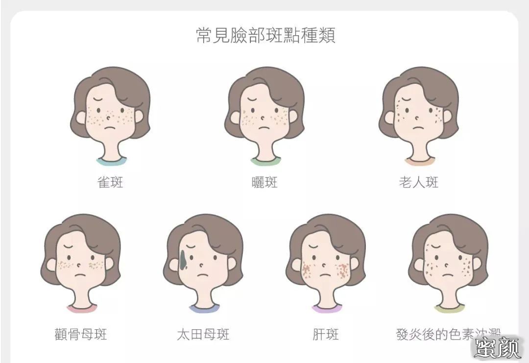 https://img.yiyiaimei.com/mnt/timg/200711/130GJ330-1.jpg