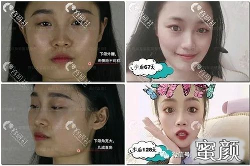 https://img.yiyiaimei.com/mnt/timg/200712/0951441T1-0.jpg