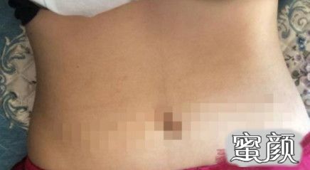 https://img.yiyiaimei.com/mnt/timg/200712/10060aX2-7.jpg