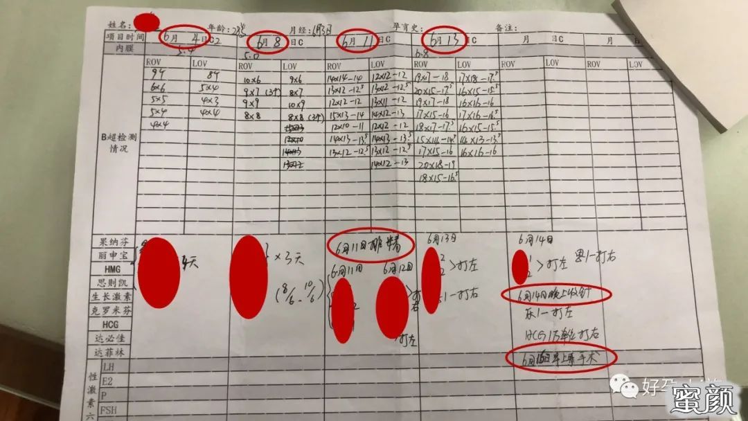 https://img.yiyiaimei.com/mnt/timg/200713/124G44059-1.jpg 案例图片
