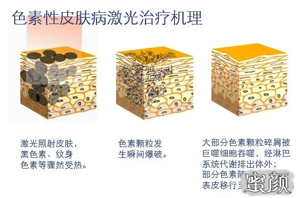 https://img.yiyiaimei.com/mnt/timg/200714/1350115155-0.jpg