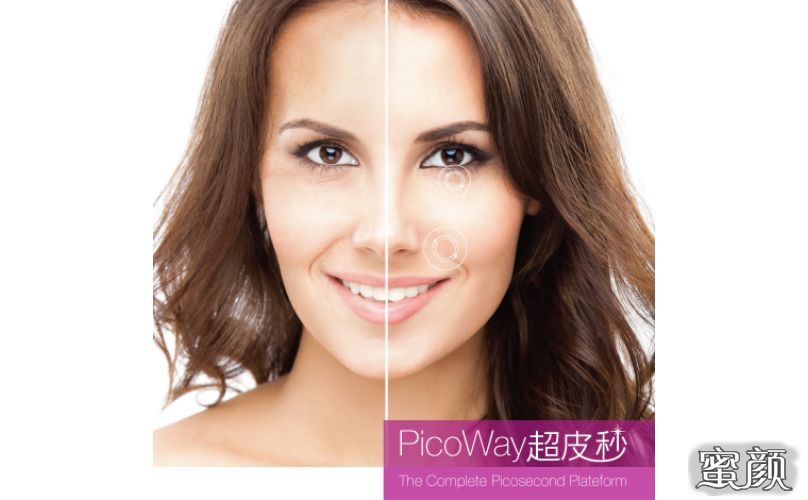 https://img.yiyiaimei.com/mnt/timg/200714/13502L2H-2.jpg