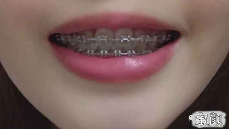 https://img.yiyiaimei.com/mnt/timg/200714/135P2I36-15.jpg 案例图片