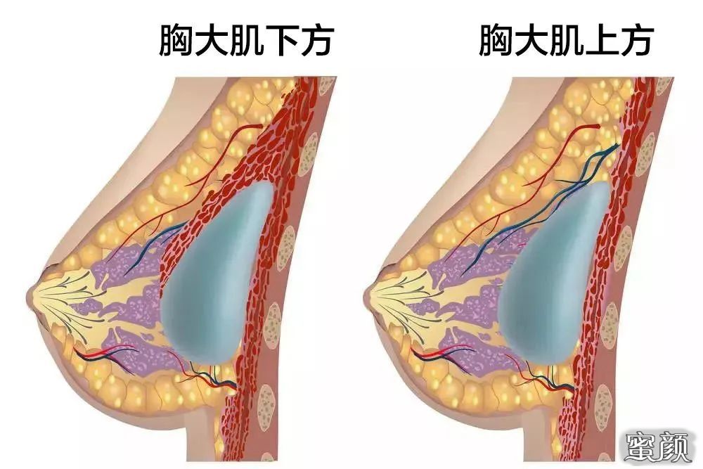 案例图片