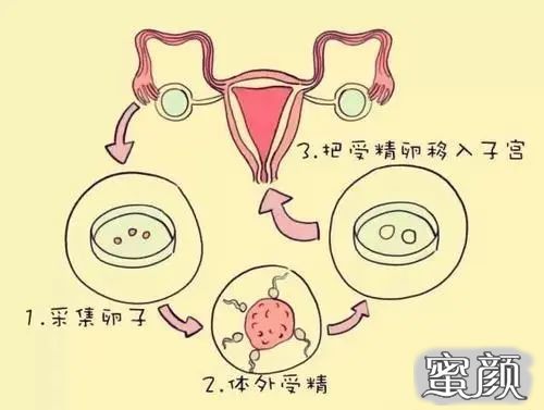 https://img.yiyiaimei.com/mnt/timg/200715/12315S2M-0.jpg
