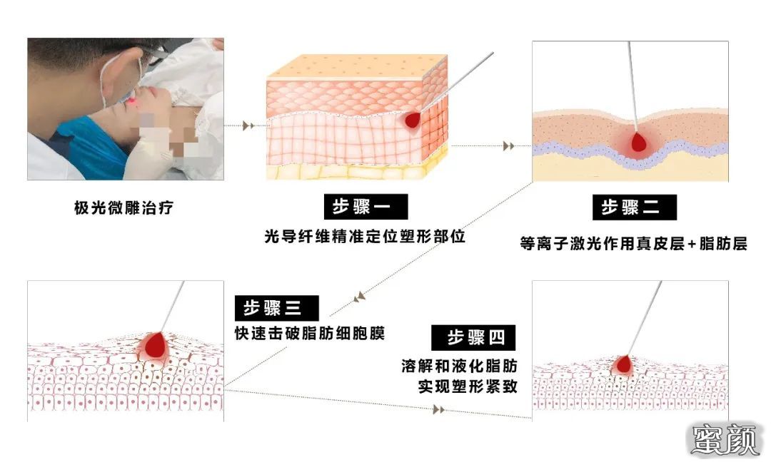 案例图片