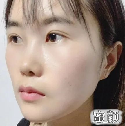 https://img.yiyiaimei.com/mnt/timg/200715/1324122616-5.jpg