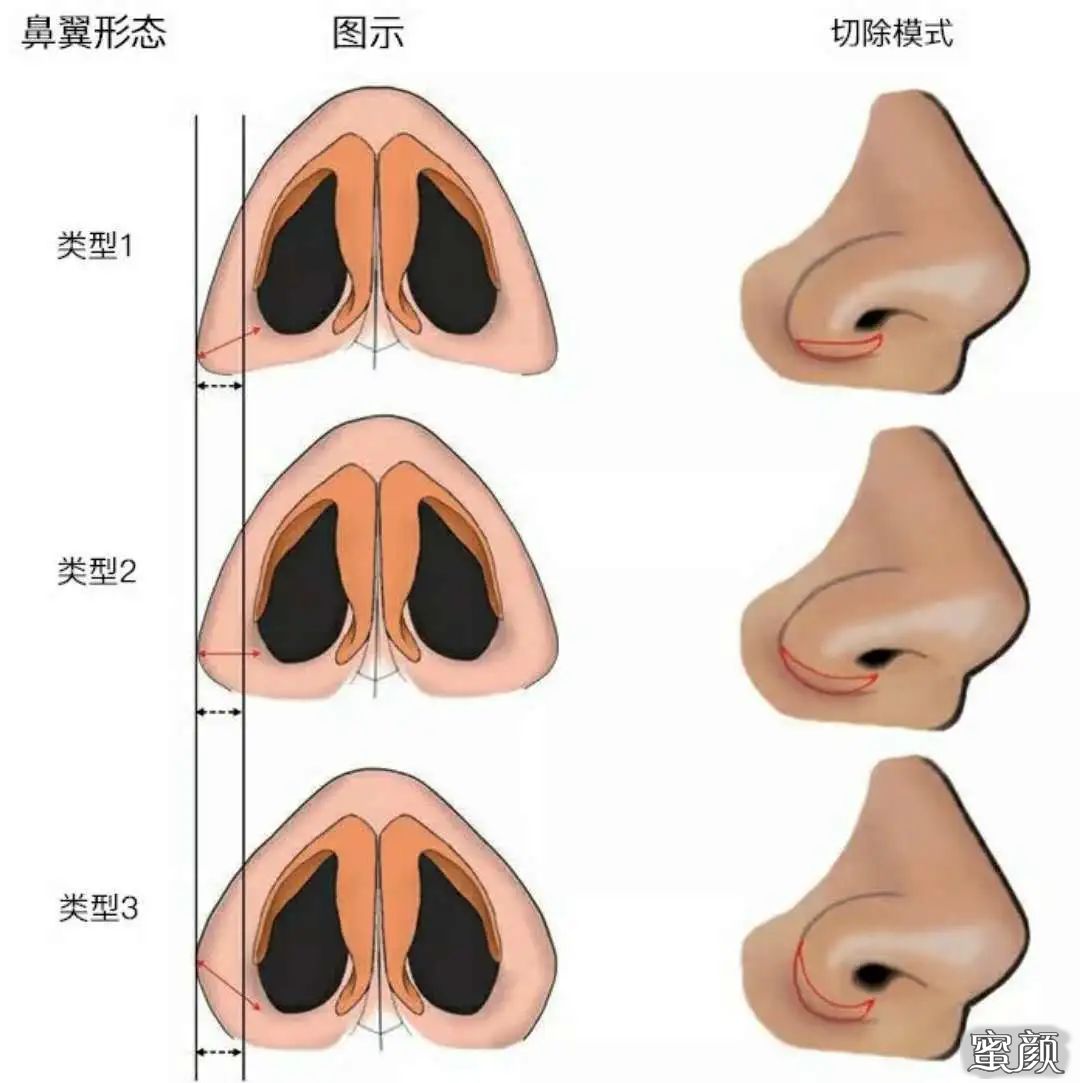 案例图片