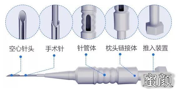 案例图片