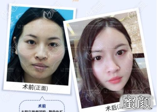 案例图片