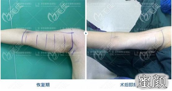 案例图片