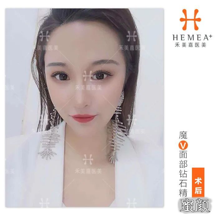 案例图片