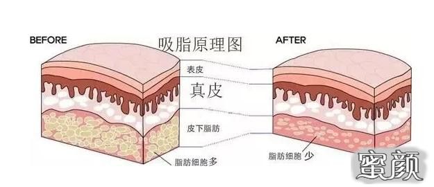 案例图片