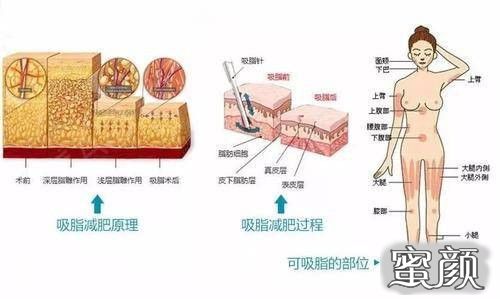 案例图片