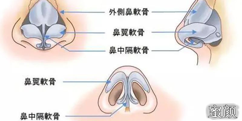 案例图片