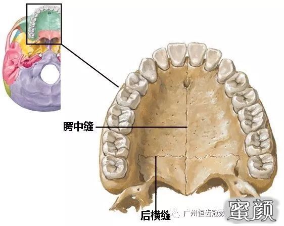 案例图片