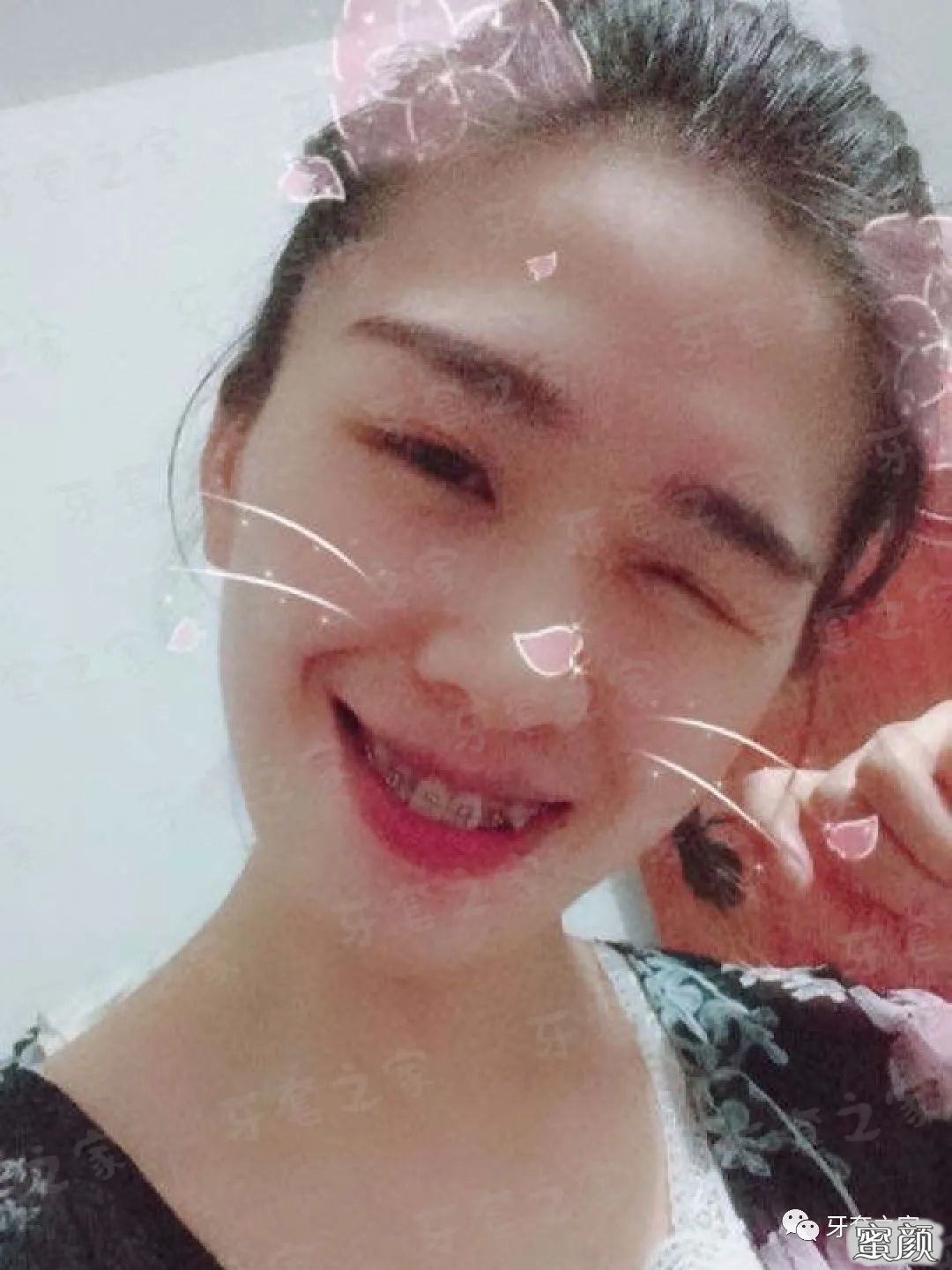 https://img.yiyiaimei.com/mnt/timg/200716/1444055221-4.jpg