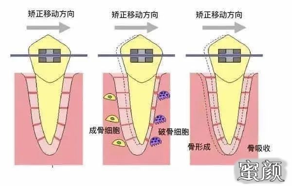 案例图片