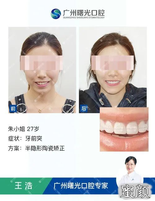 案例图片